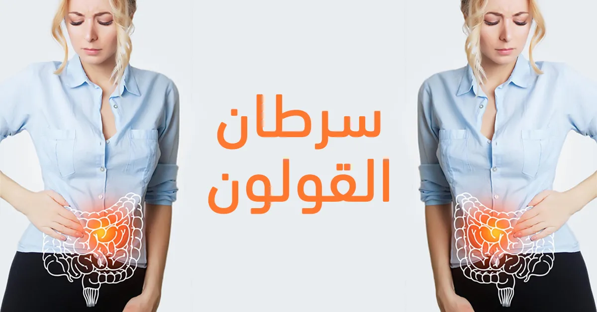 سرطان القولون